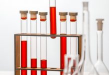 Top laboratoare acreditate: certificările europene ale Regina Maria